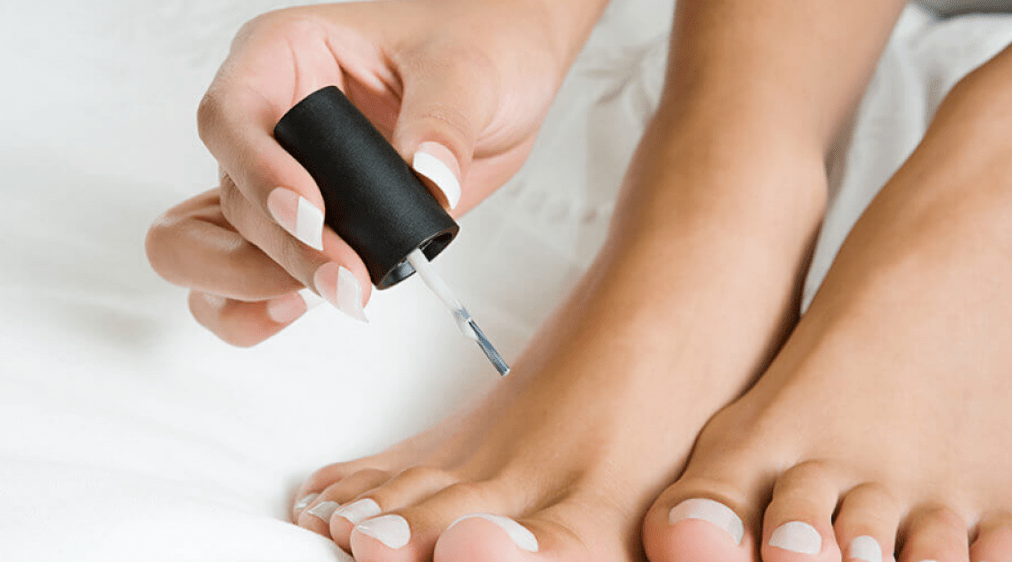 Daumenpilzbehandlung mit Nagellack