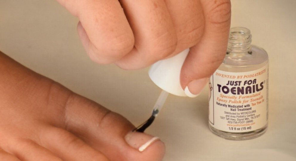 Nagellack gegen Großzehenpilz