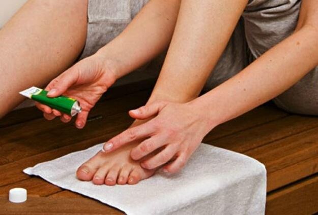 Tragen Sie zur Behandlung von Mykosen eine antimykotische Salbe auf die Füße auf. 