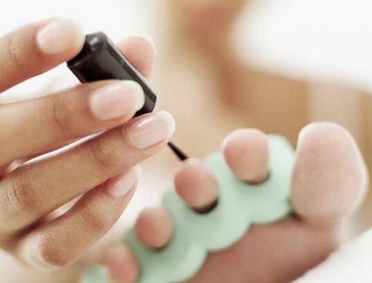 Behandlung der Nägel mit Nagellack bei einer Pilzinfektion