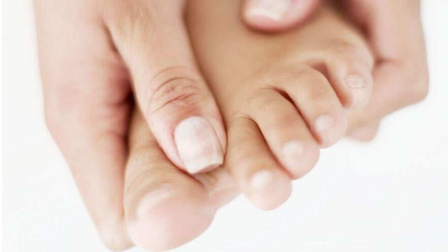 Juckreiz aufgrund von Nagelpilz an der großen Zehe
